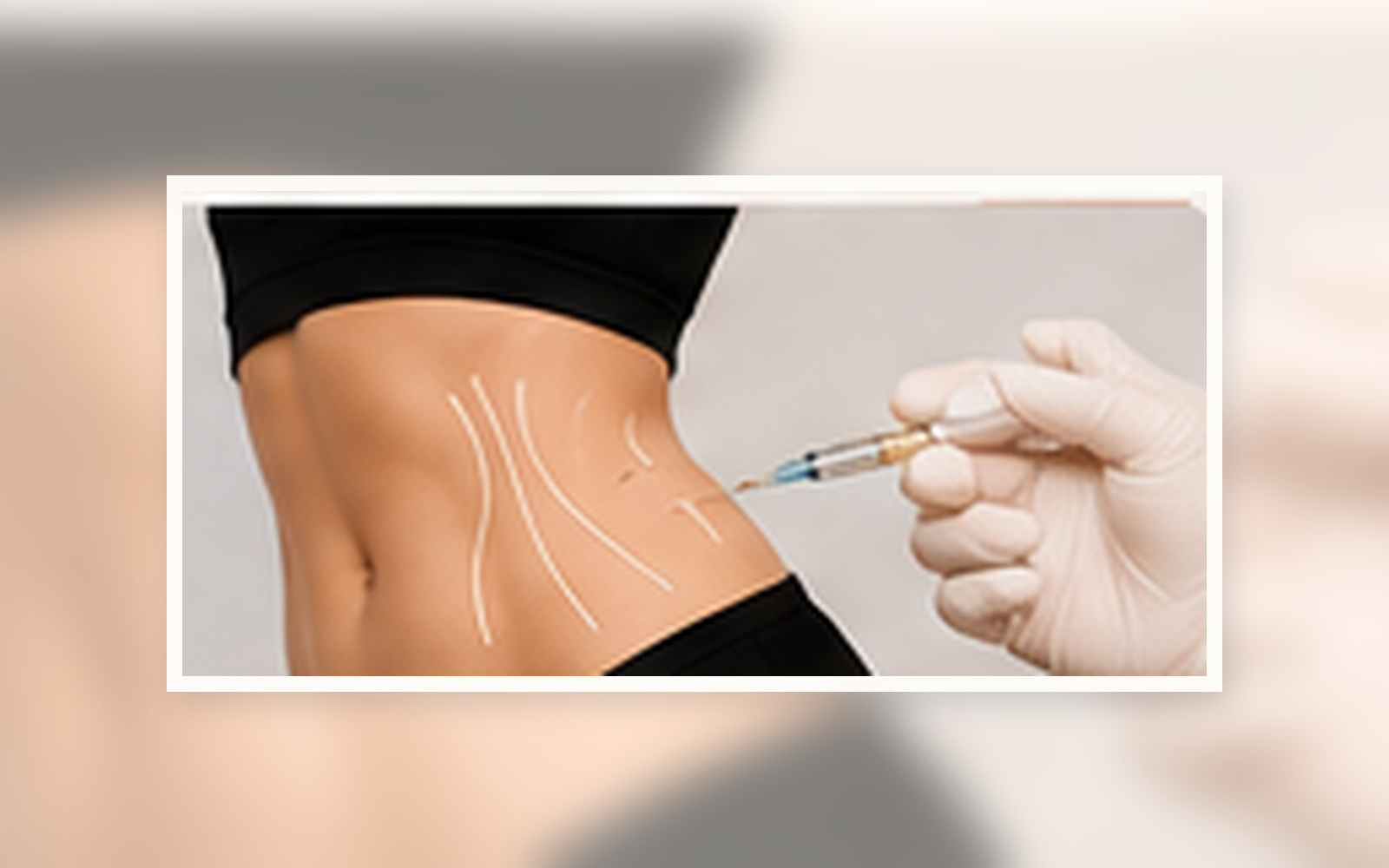 Fat Injections