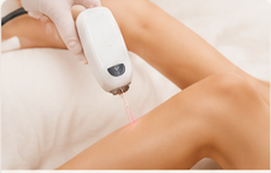 Laser & IPL Hair Removal