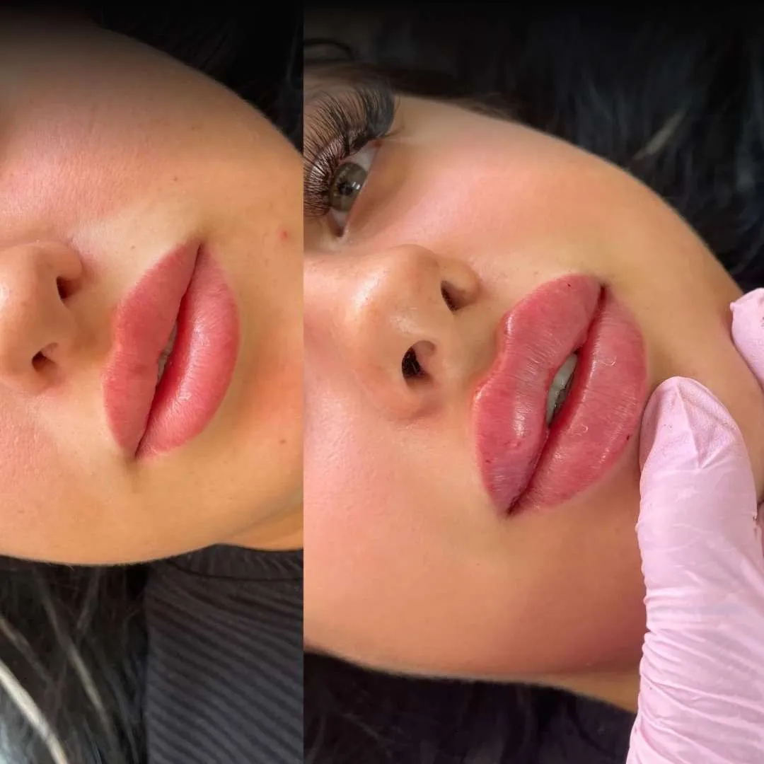Russian Lips · before and after