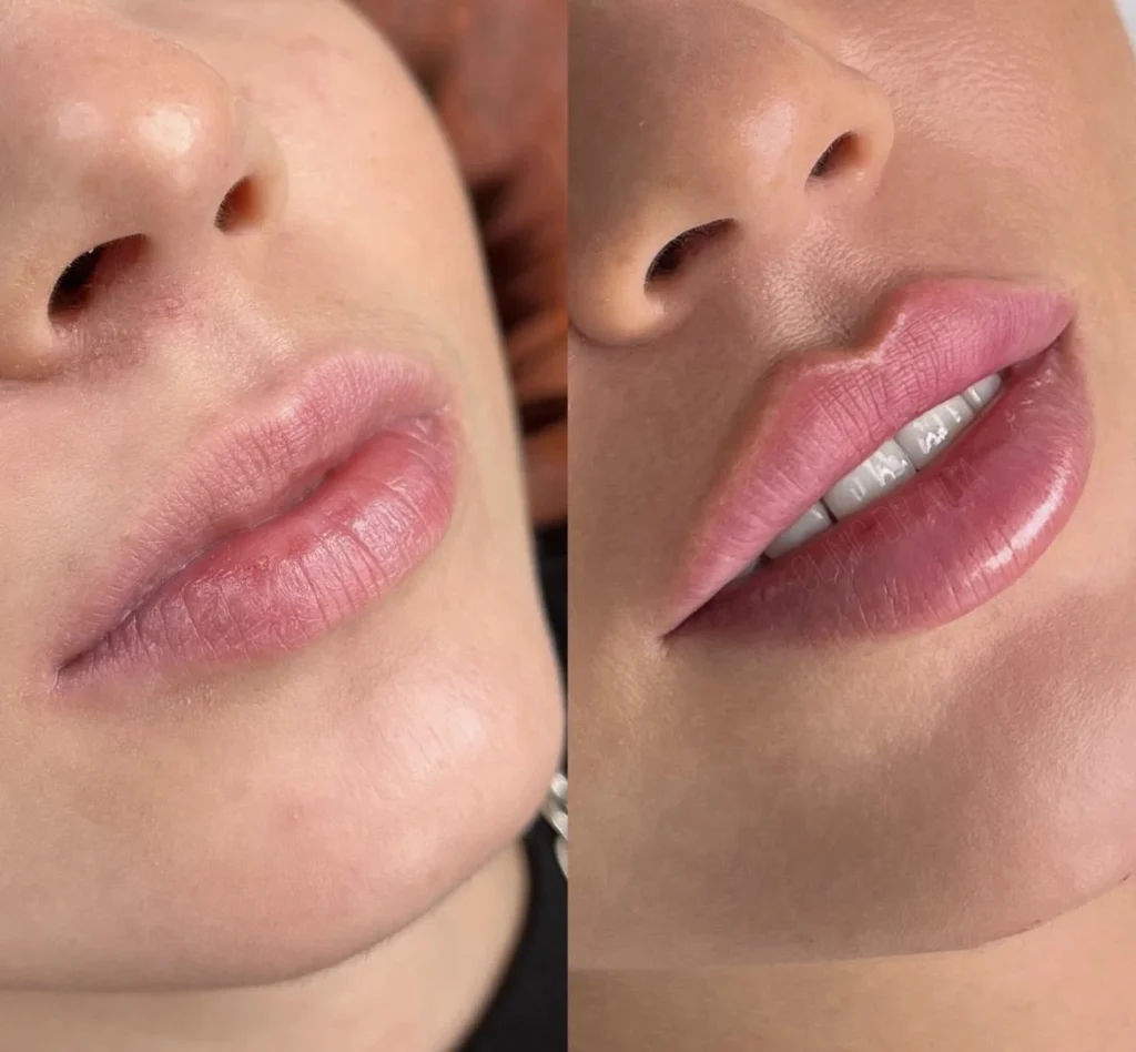 Russian Lips result 3